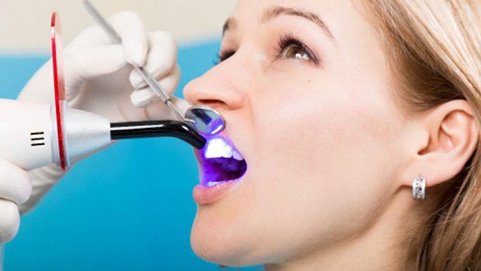 Patient receiving cosmetic dental bonding in Philadelphia