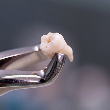Tooth held in a pair of forceps