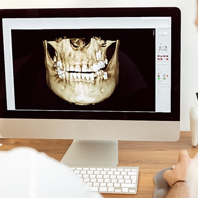 3 D digital x-ray of jaw image on computer screen