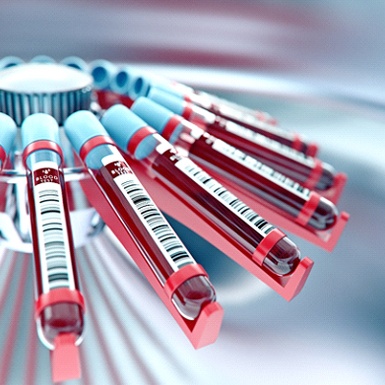 Blood being spun in centrifuge for PRF or PRP therapy