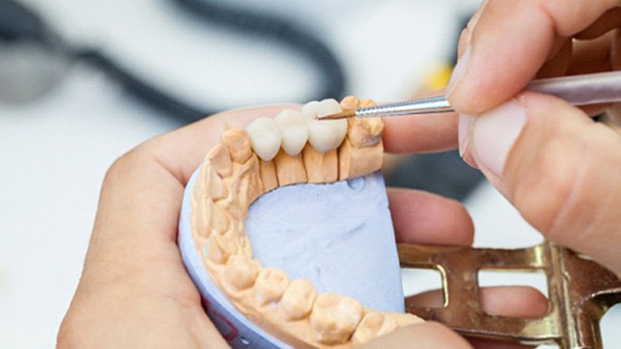 A dental technician working on a dental bridge