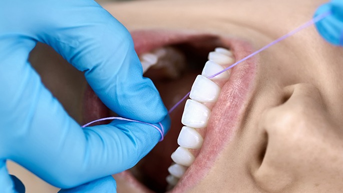 showing woman x-ray at dental exam in Philadelphia 