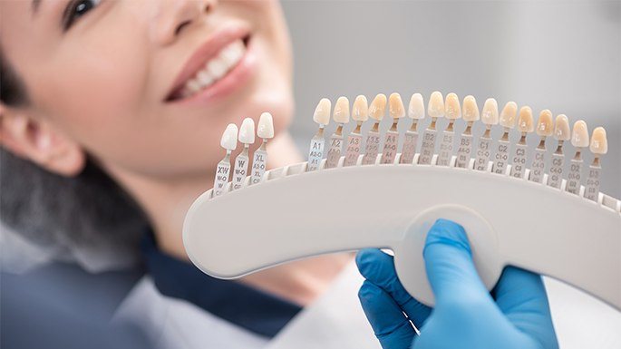 Smile compared with porcelain veneers color chart during cosmetic dentistry visit