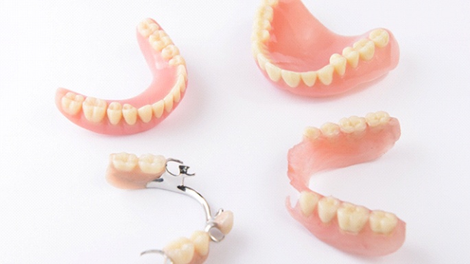 full and partial dentures showing the types of dentures