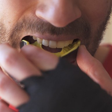 Man placing a mouthguard into his mouth