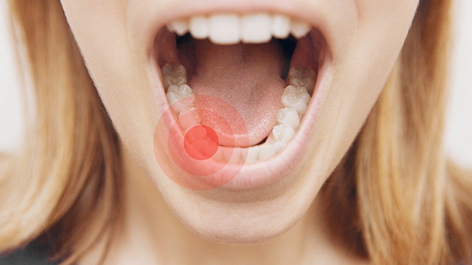 A red signal pointing to a woman’s damaged tooth