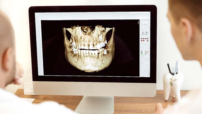 dentists looking at 3D CT cone beam scanner in Philadelphia