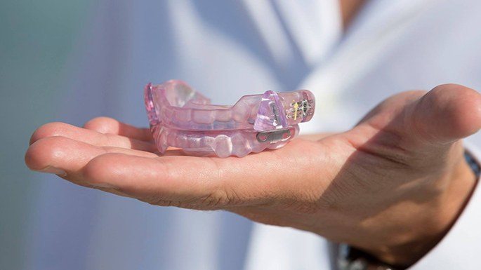 Hand holding nightguard for bruxism