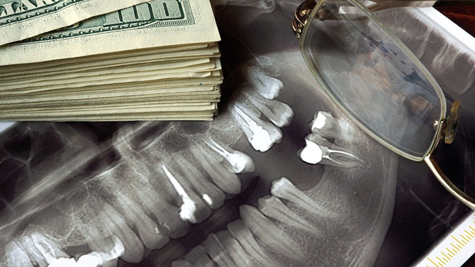 Money next to a dental x-ray