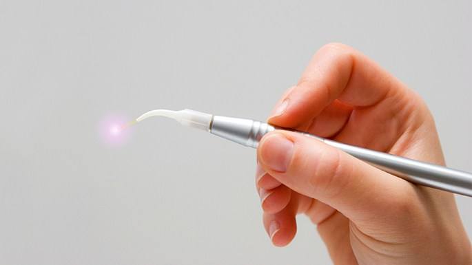 Soft tissue laser dentistry hand tool