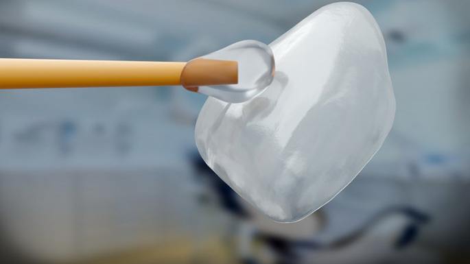 A close-up of porcelain veneers in Philadelphia