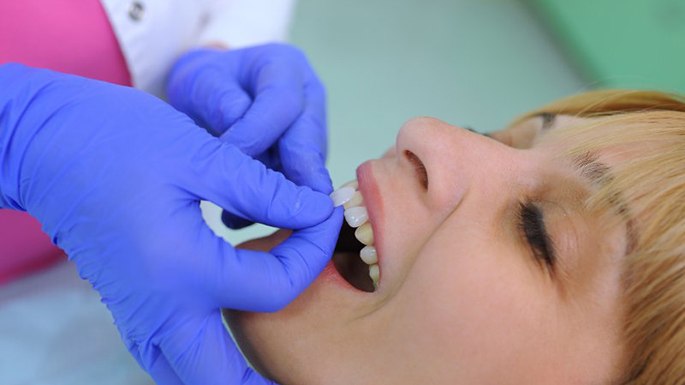 A woman receiving veneers in Philadelphia