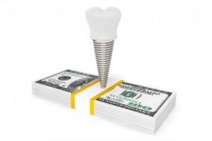 dental implant and money illustration